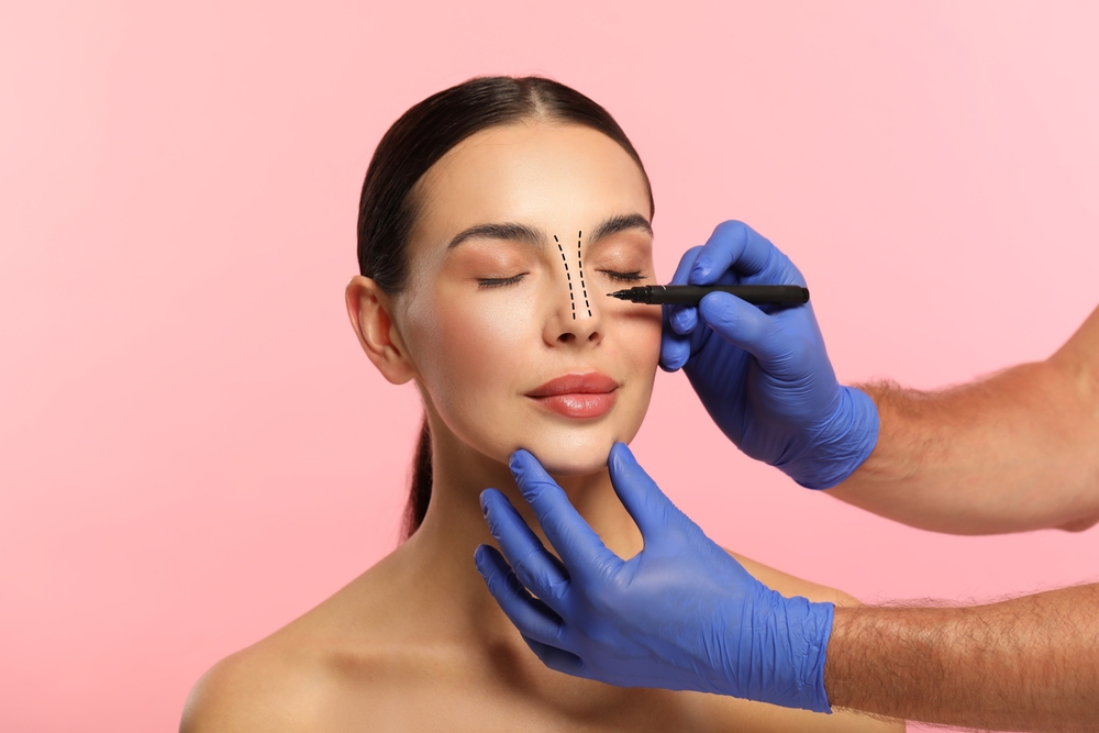 Woman's face being drawn on in preparation for rhinoplasty in Los Altos, CA