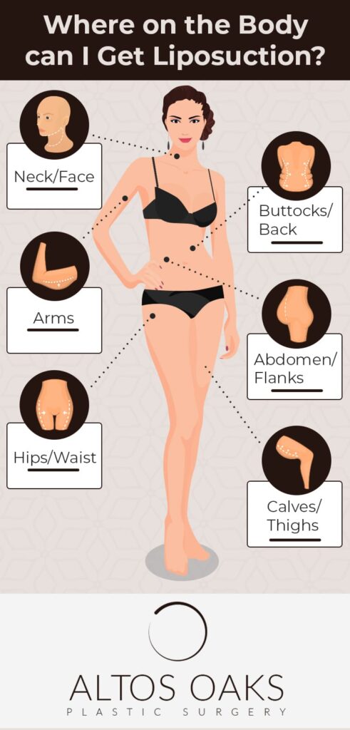 Where-on-the-body-can-i-get-liposuction
